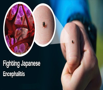 Assam: Japanese Encephalitis claims 63 lives, infects 347