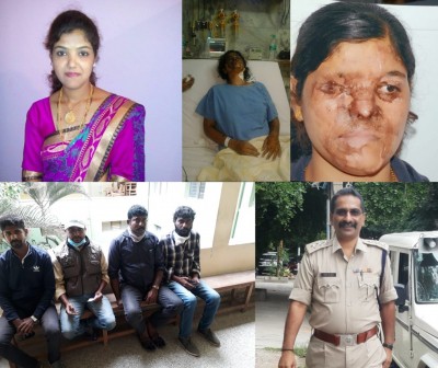 Delayed but not denied: Justice for K'taka acid attack victim